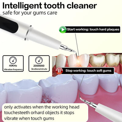 Ultrasonic Electric Tooth Cleaner
